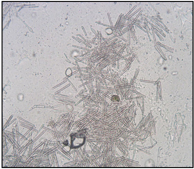 Calonectria pseudonaviculata, the causal agent of Boxwood Blight, produces conidia that are hyaline (clear) and spindle-shaped (shown above).Conidiophores possess stipe extensions that terminate with a pointed vesicle. A few of the small, elliptical conidia of Volutella buxi, the causal agent of Volutella blight, can also be seen in the upper-right and lower-right corners of this image. Photo credit: N. Goltz, 2023.