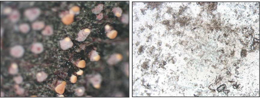 Salmon-colored, erumpent pads produced by Nectria cinnabarina (left), and hyaline endoconidia of Thielaviopsis basicola (right) are just some of the signs observed and used to provide diagnoses this year. Photos: Nick Goltz. 