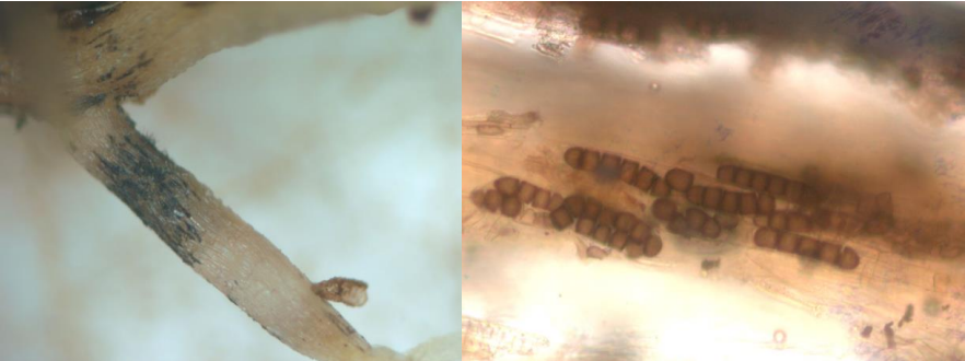 Figuras 5 y 6: Áreas longitudinales de color negro en raíces infectadas (izquierda) yesporas hibernantes de paredes gruesas. Fotos de J. Allen