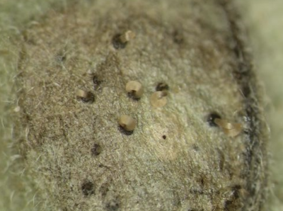 microscopic image of septoria spores on tomato