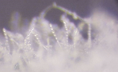 microscopic image of powdery mildew